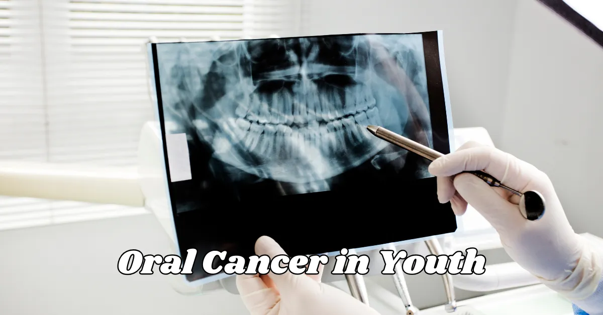 Oral Cancer in Youth